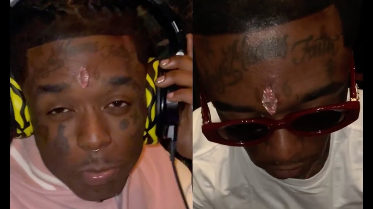 Lil Uzi Gets a $24M Pink Diamond Head Implant. 