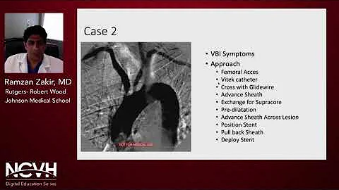 Dr. Ramzan Zakir, Subclavian and Brachiocephalic Stenting: Indications and Techniques
