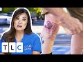 Patient Suffers From A Large Bump That&#39;s Growing Out Of Control | Dr Pimple Popper