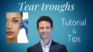 Dermal Fillers: Tear Troughs! Truths & Tips