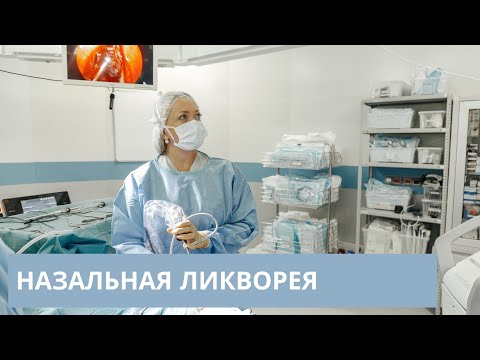 Назальная ликворея