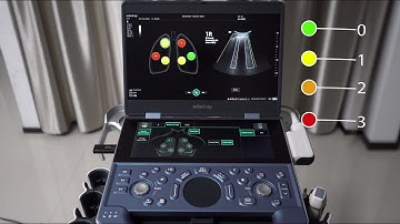 Mindray-ME Smart B-Line Demonstration