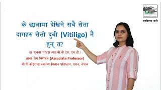 Vitiligo in Nepali | सेताे दुबी जस्तै देखिने अन्य राेगहरू | छाला राेग विशेषज्ञ | Dr. Suchana | भाग ३