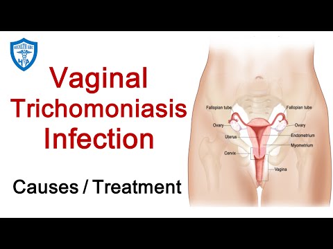What is Trichomoniasis? | Sexually transmitted diseases STD |Symptoms, Causes, and Treatments