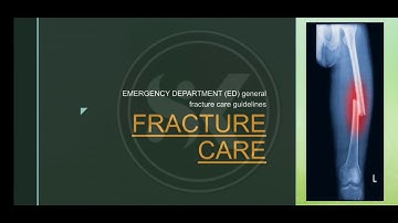 Fracture care Guidelines (General ED guidelines)