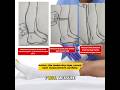NMC OSCE Anti-Embolism Stocking Measurement 2026