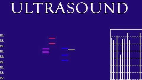Haddaway - What is Love on Gravis Ultrasound