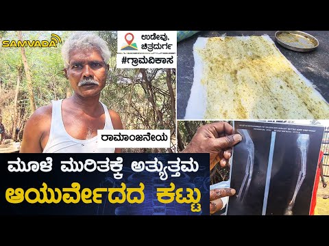 ಮೂಳೆ ಮುರಿತಕ್ಕೆ ಅತ್ಯುತ್ತಮ ಆಯುರ್ವೇದದ ಕಟ್ಟು | ರಾಮಾಂಜನೇಯ