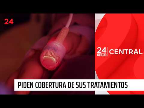 AME: piden cobertura de sus tratamientos tras revés judicial | 24 Horas TVN Chile