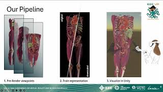 Multi-Layer Gaussian Splatting for Immersive Anatomy Visualization