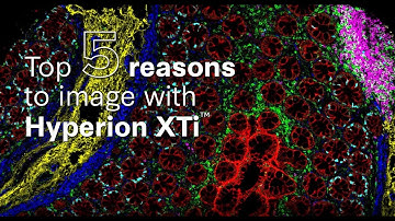 Five reasons to choose the Hyperion™ XTi Imaging System
