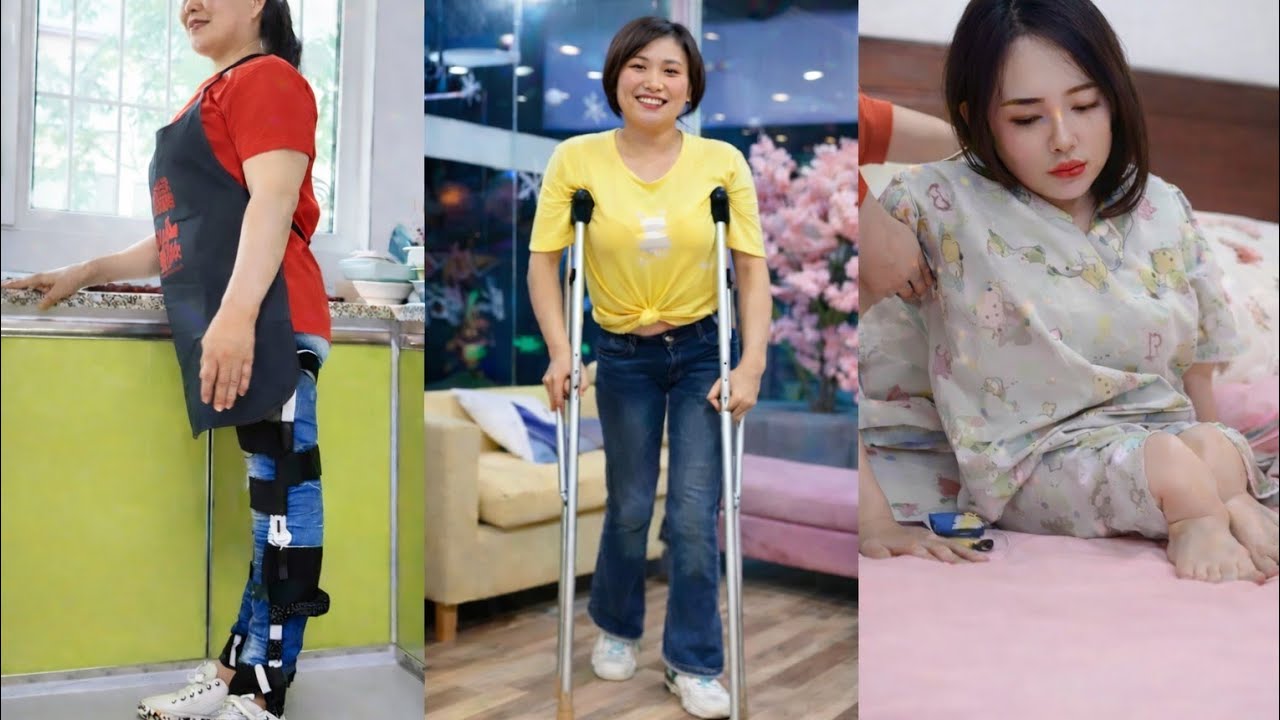 ✅🚨SEVERE LEG CONDITION🍉 | How These Women Move With Support