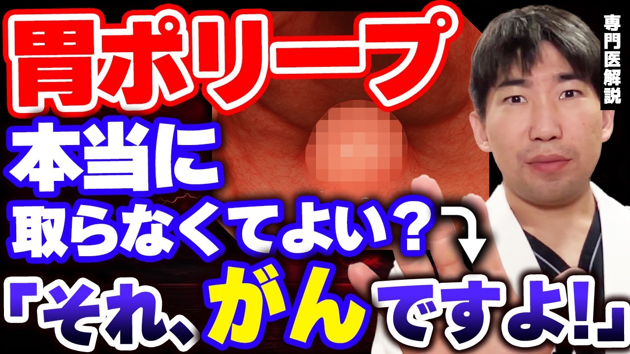 【要注意】胃ポリープでも“がん”になる！放置NGの悪性ポリープ3種類を解説します【内視鏡専門医解説】