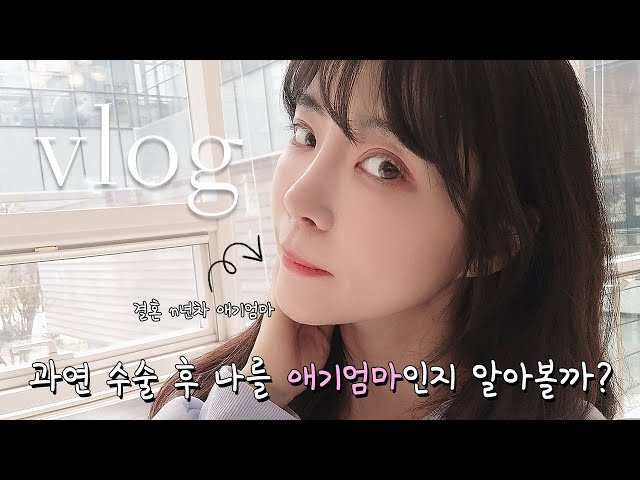반니성형외과 과연 수술 후 나를 애기엄마인지 알아볼까?