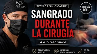 SANGRADO EN CIRUGÍA DE AUMENTO DE PENE. ¿Qué pasa si hay un sangrado durante la cirugía? | Caso REAL