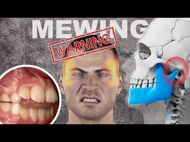 Mewing: the viral technique for jaw definition - HIGHXTAR.