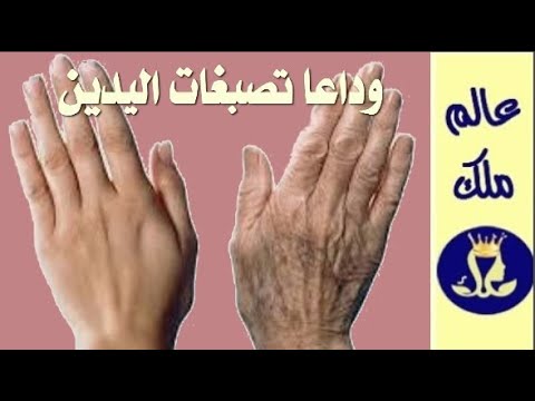 اقوى وصفة للقضاء نهائيا على البقع البنية والتصبغات باليدين لسن ال 50