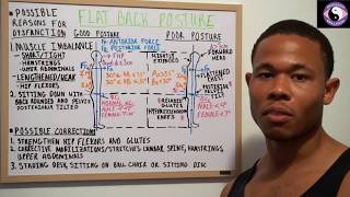 Flat Back Posture Causes and Corrections