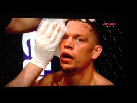 Conor McGregor vs Nate Diaz fight footage