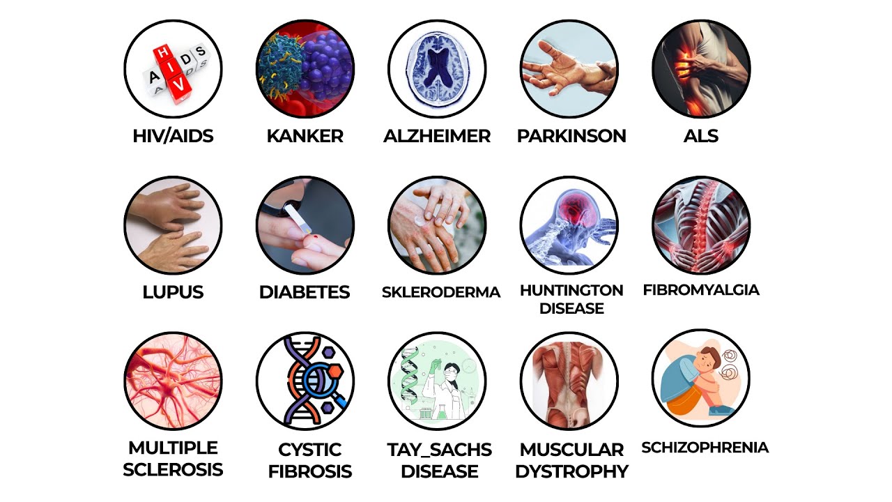 Seluruh Penyakit Yang Obatnya Belum Ada !