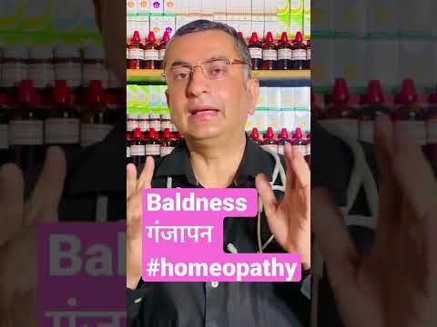 Baldness सर के बाल झड़ना || Alopecia / Hairfall || Natural Homeopathic remedies || होम्योपैथिक उपचार