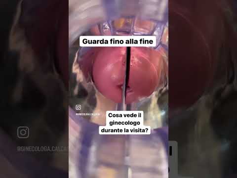 Video: Ginecologo