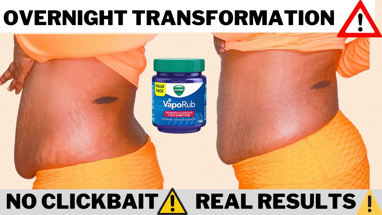 HOW TO GET A FLAT STOMACH OVERNIGHT with Vicks vapor rub |Life Hack with Instant RESULTS MUST WATCH!