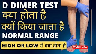 D dimer test kya hota hai | d dimer test in Hindi | d dimer normal range