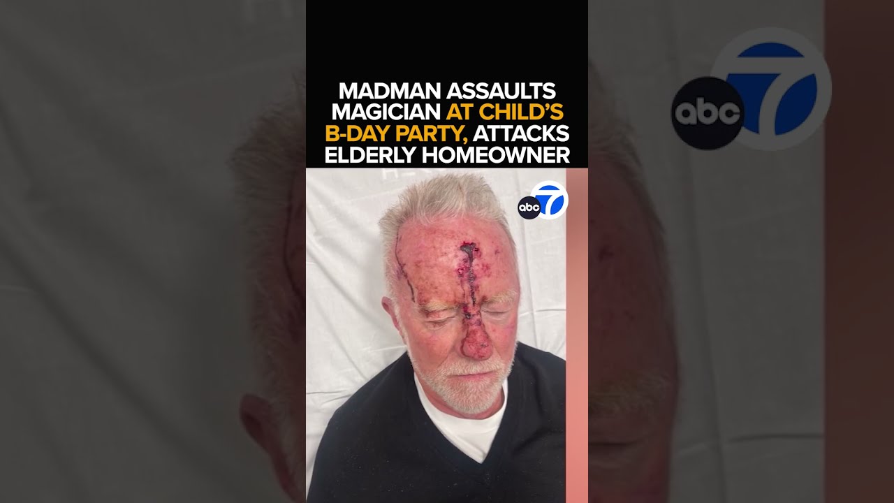 Man Arrested In String Of Shocking Attacks Pacific Palisades