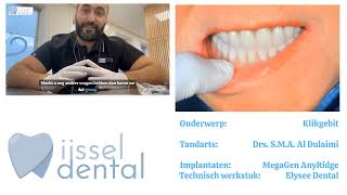 Download Lagu Klikgebit op implantaten – uw traject, kosten en uitvoering bij tandartspraktijk IJssel Dental MP3