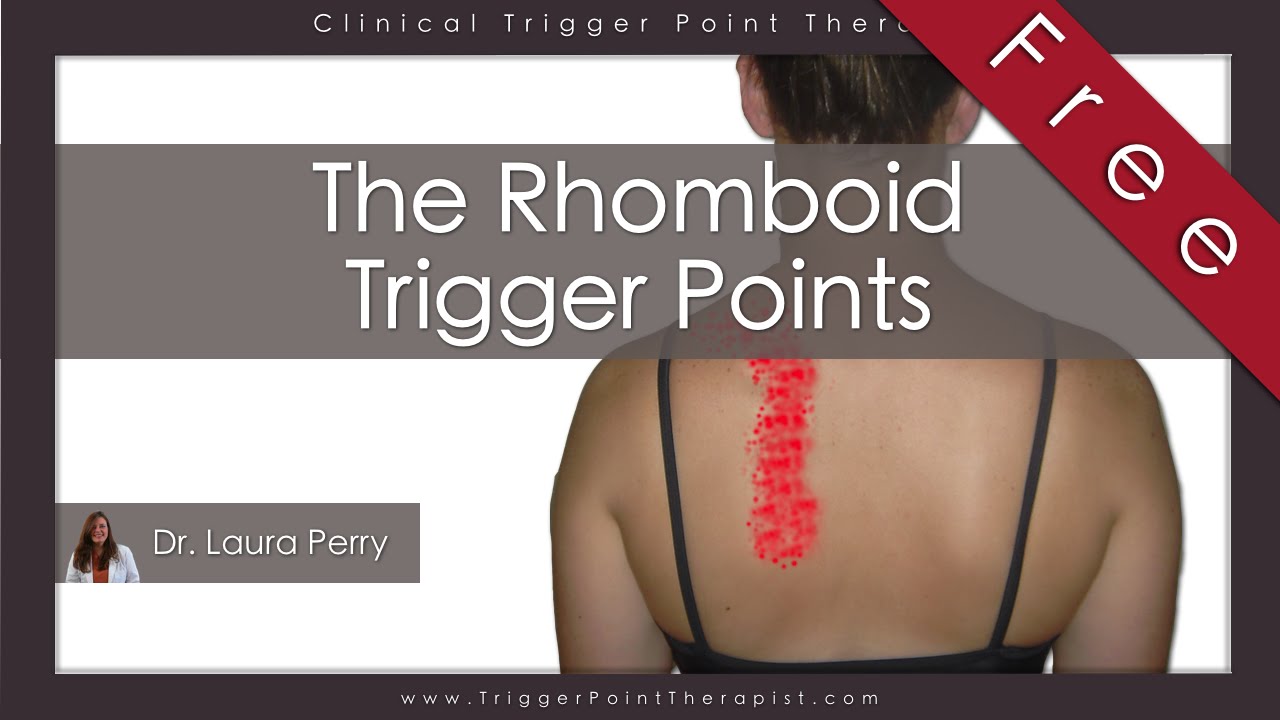 The Rhomboid Trigger Points (Free Full Video) - YouTube