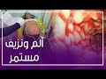 العلاج بـ130 ألف جنيه ماهو مرض كرون المصاب به حمو بيكا