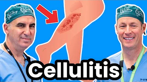 Cellulitis Explained By Infectious Disease Doc. Red, Sore And Swollen