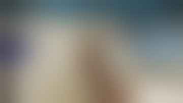 DynaBunion 4D Minimal Incision Lapidus System - Cadaveric Surgical Demo