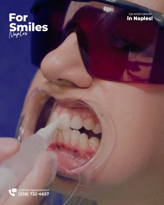 Brighten Your Smile with Professional Teeth Whitening | For Smiles Naples, FL