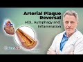 Arterial Plaque Reversal: HDL, Autophagy & Inflammation