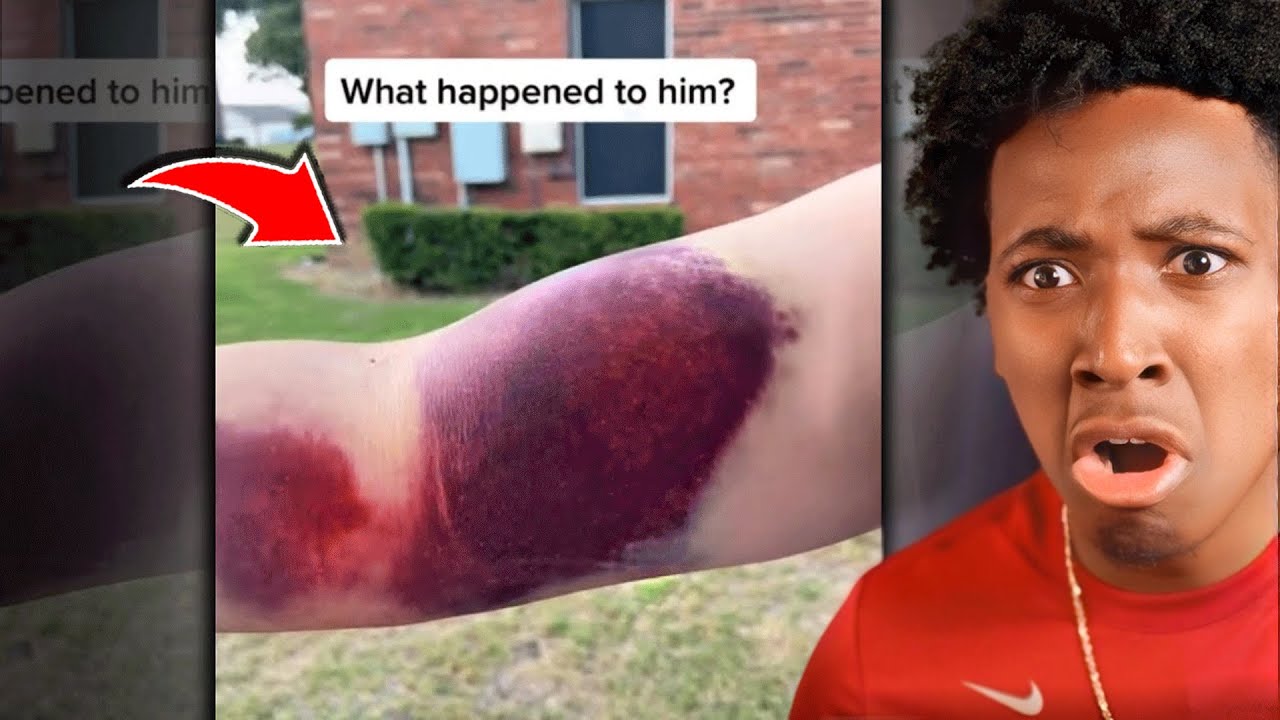 Best Fails Ever Caught on Camera 😂 - YouTube