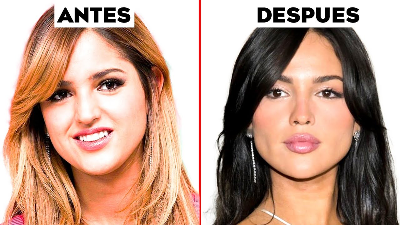 Análisis facial de Eiza González y sus cirugías plásticas a través de los años ¿cuánto le costó ?💰