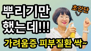 뿌리기만 했는데‼️가려움증 피부질환 싹 사라져요💢무좀 알레르기 두드러기 아토피 등 초간단 관리법