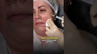 Липолитики в лицо #доктор #косметолог #липолитики