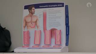 Eosinophilic Esophagitis (EoE) in Children: Symptoms, Diagnosis & Treatment