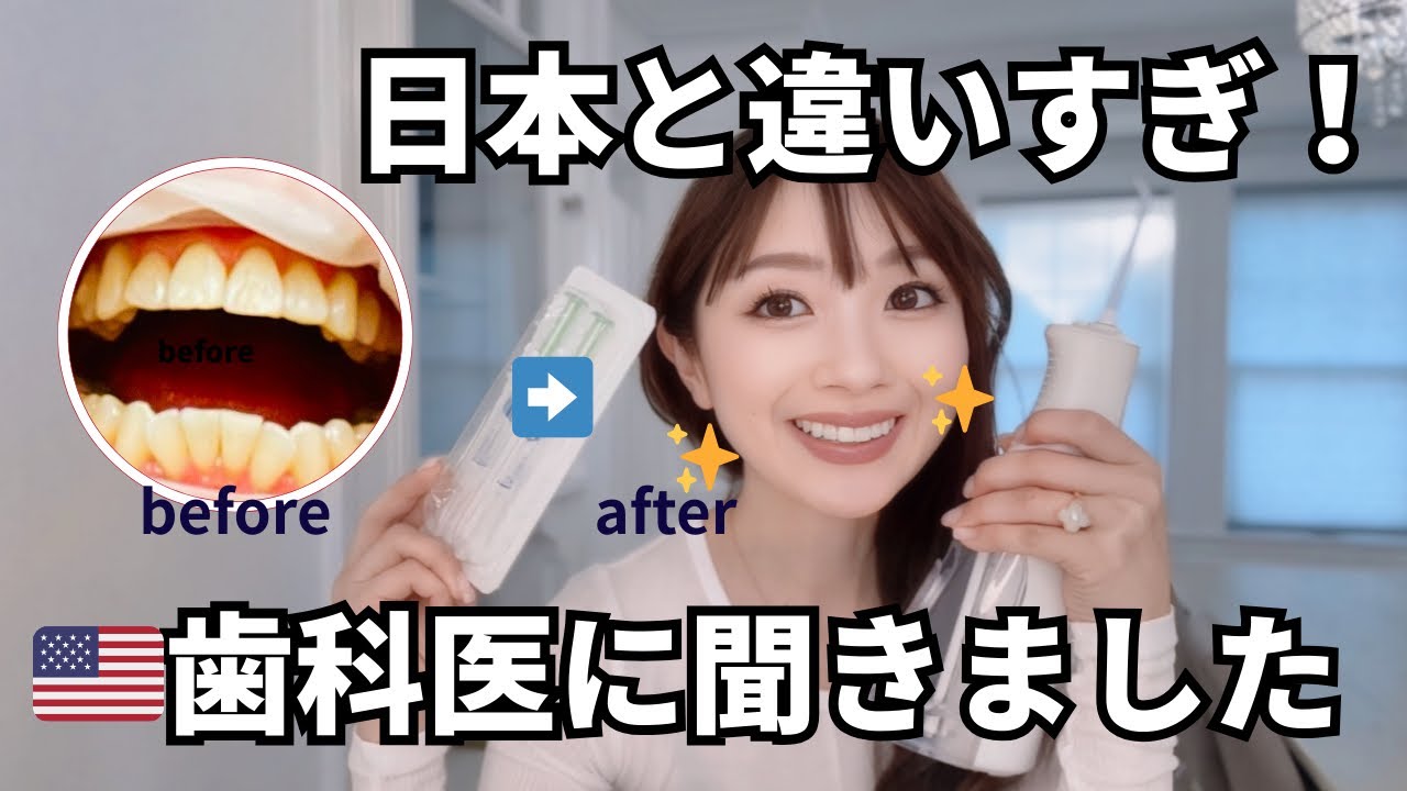 アメリカの歯事情と歯医者が教えてくれたセルフホワイトニング