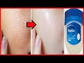 Apply Vaseline On Your Skin and See The Magic || Amazing 5 Vaseline Beauty Hacks | Beauty | Hacks
