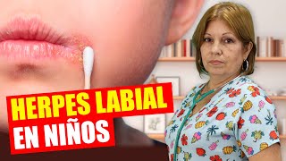 ¿Granos en la BOCA? 😖 Descarta el HERPES BUCAL Urgente 🚨