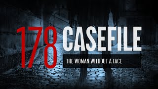 Case 178: The Woman Without a Face