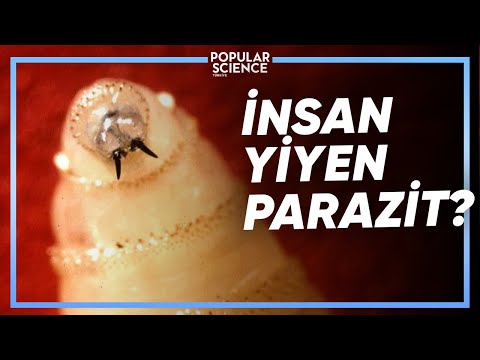 Video: Parazitlere Neden Dikkat Etmelisiniz?