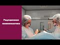 Редукционная маммопластика как уменьшить грудь