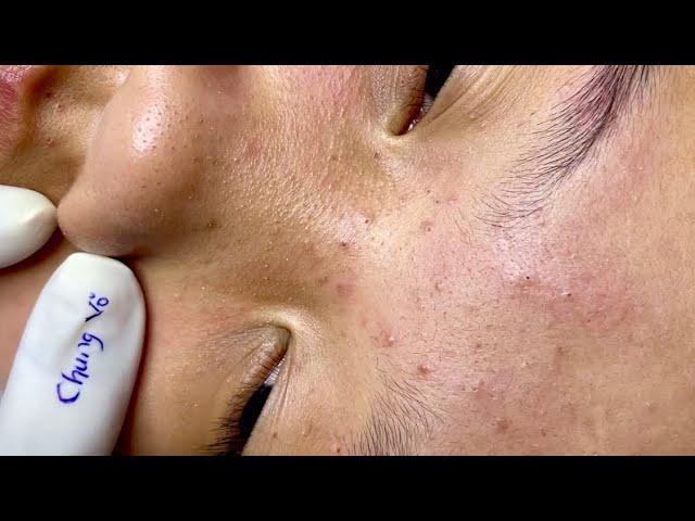 Satisfying video with Chung Vo Spa | 197