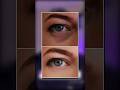 Surgeon's Secret to Looking Less Tired