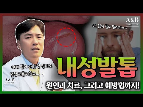 내성발톱 끝장내는 법?? / 피부과 의사가 알려드립니다 / 연세에이앤비 피부과 이해진원장